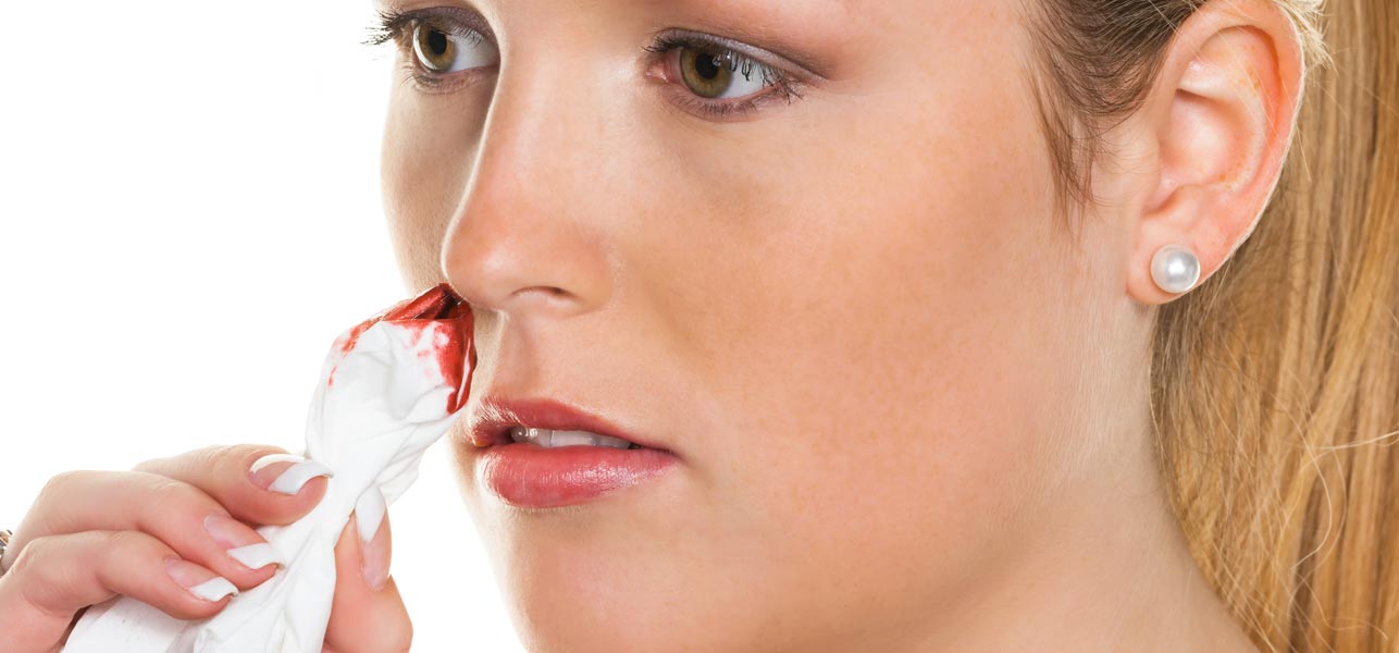 10-Effective-Home-Remedies-To-Stop-Nose-Bleeding1